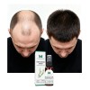 Sérum Crecimiento Cabello Calvicie Favorece Crecimiento 30ml