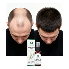 Sérum Crecimiento Cabello Calvicie Favorece Crecimiento 30ml