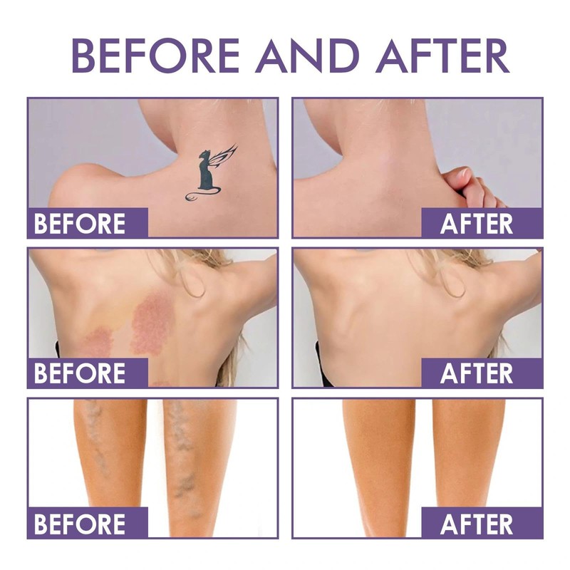 Body Concealer & Leg Makeup - Waterproof, Full Coverage Tattoo