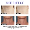 2x Neck Cream Tighten & Lift Firming, Neck Firming Cream
