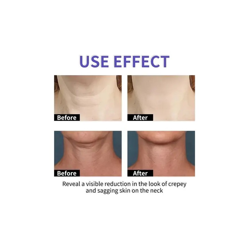 2x Neck Cream Tighten & Lift Firming, Neck Firming Cream