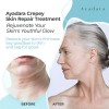 Ayadara Crepe Skin Repair Treatment, Aging & Wrinkle Lotion with