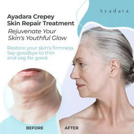 Ayadara Crepe Skin Repair Treatment, Aging & Wrinkle Lotion with Hyaluronic Acid