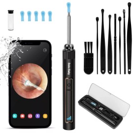 Duke Baby Black Ear Wax Removal,Ear Wax Removal Tool with 1296P HD Camera and 6 LED Lights