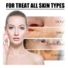 30 Ml De Cafeína Para Rostro, Antienvejecimiento Facial Para