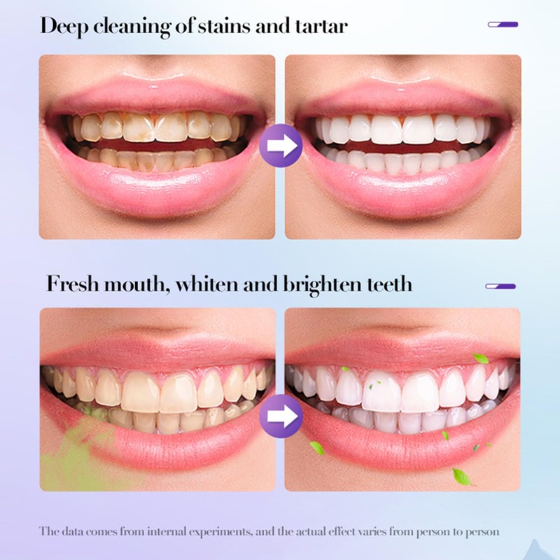 Whitening Toothpaste for Radiant White Teeth, 100 g Teeth Whitening