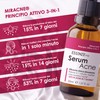 Serum Acne Essenze.me - Trattamento Anti-Acne Veloce, Elimina Brufoli e