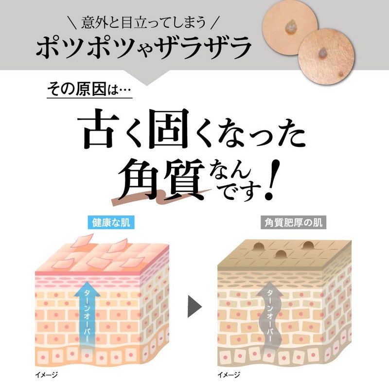 IpoCare Lotion Vitamin D3 Exfoliating Grain Care, Potatoes Countermeasure