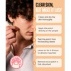 Absorbzit - The Everyday Hydrocolloid Pimple Patches, Ultra Thin Spot