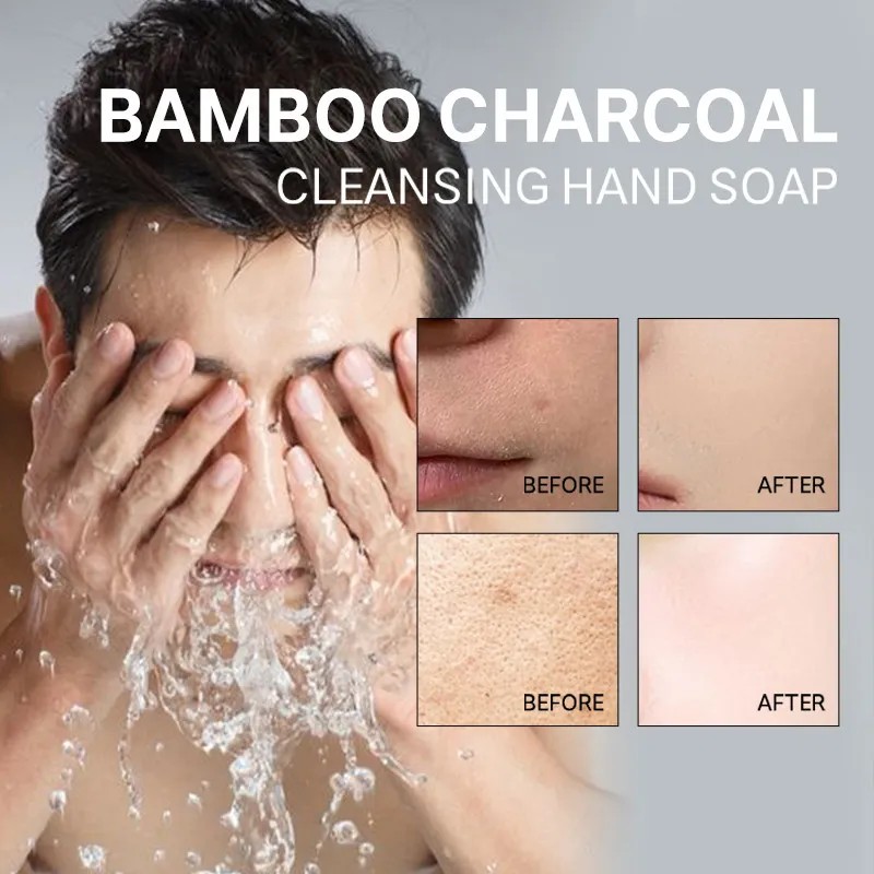 Aceite De Carbón U Soap Para Hombres Y Mujeres Oil