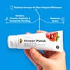 Whites Beaconsfield Whites Beaconsfield, Veneer Composite, and Natural Teeth Whitening