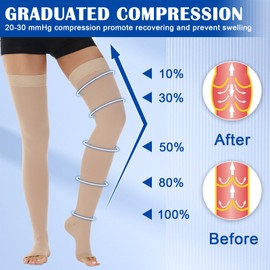 Ailaka Thigh High Medical Compression Stockings for Women Men, Open Toe Firm 20-30 mmHg Graduated Compression with Silicone Band for Varicose Veins, Edema, Post-Surgery
