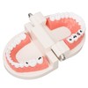 Dental Disease Caries Teeth Model Resin Simulation Teaching Prop Dental