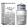 Máscara Facial De Arcilla En Barra, Fórmula Suave, Fácil De