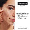 Neutrogena Clear and Defend Ultra-Thin Blemish Patches 24ct