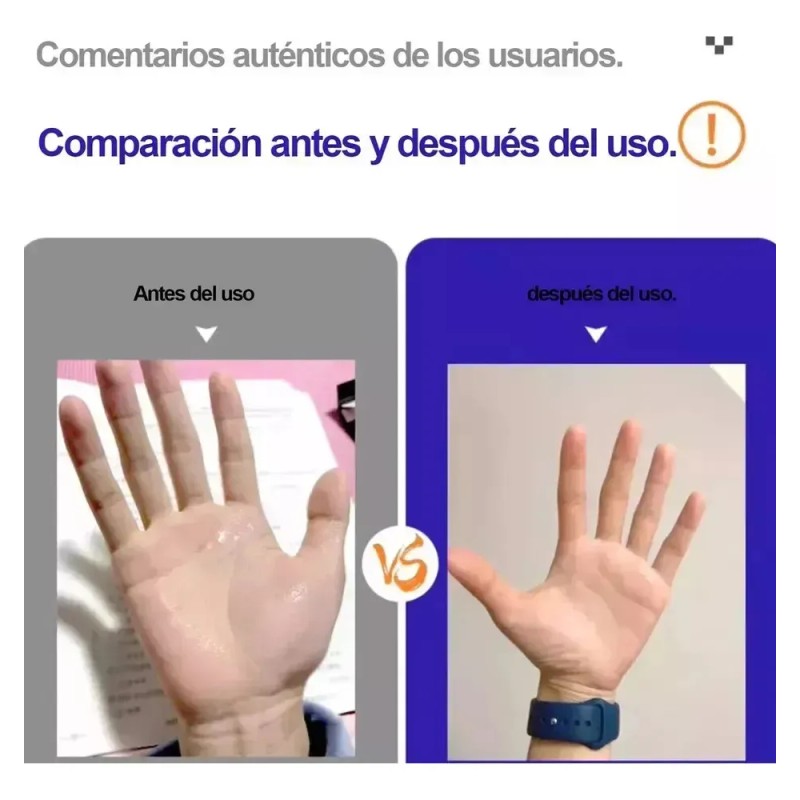 Crema De 70 G Para Dedos, Pies Y Axilas Sudorosos