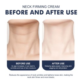 Neck Creams for Firming Roller,Neck Firming Tightening Cream,Double Roller Massage Neck Tightening Cream,Tighten and Lift Neck Cream,Firming Cream for Loose Skin,Wrinkle Crea-m for Women,Night Cre-am