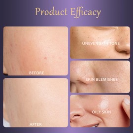 2 Stück Suprem Creme Body Perfector, Body Coverage Perfector, Körper Make Up Wasserfest mit Doppelbandage Luftkissen Puderquaste, Wasserfestes,Lang Anhaltendes Körper-Make-Up,Deckt Sonnenschäden