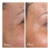 Crema Facial Manchas/arrugas Baba De Caracol Shelo Nabel