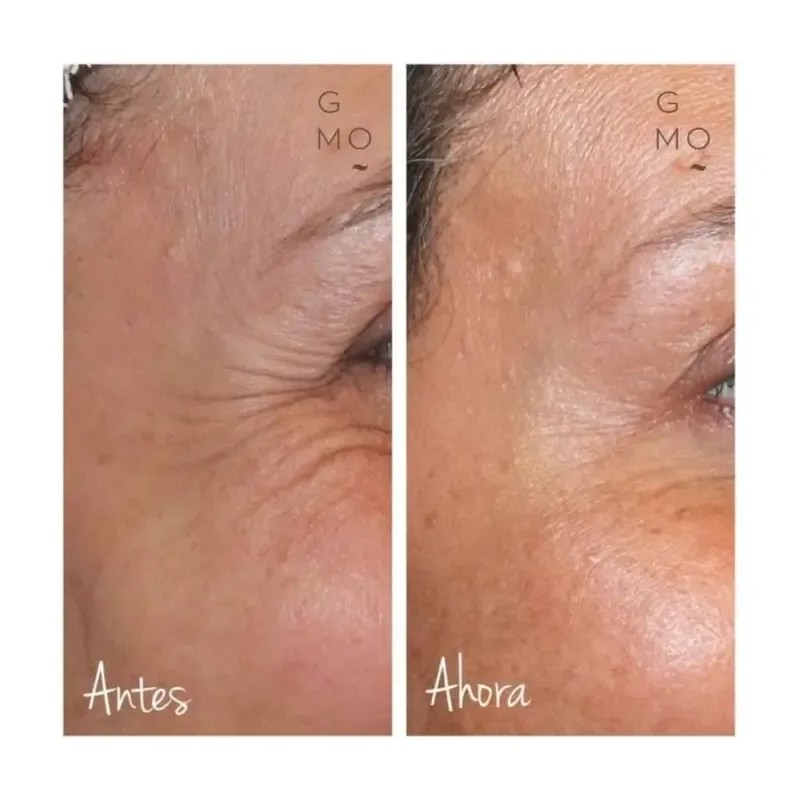 Crema Facial Manchas/arrugas Baba De Caracol Shelo Nabel