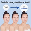 Aknederm Mattifying Face Lotion Against Pimples & Acne 2 x
