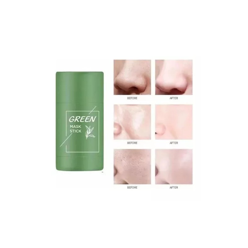 Kissnicor Mascarilla Original Green Puntos Negros Acné Granos Grasa