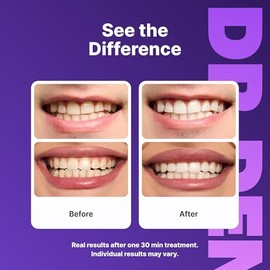 DRDENT Tiras blanqueadoras de dientes moradas, 21 tratamientos, seguras para esmalte, blanqueamiento dental no sensible, blanqueamiento sin ningún dañ