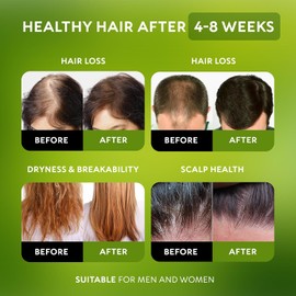 Aceite de Batana para el crecimiento del cabello Aceite de Batana 100% crudo y orgánico, prensado en frío y puro sin refinar Mascarilla capilar de Batana para mujeres y hombres Mejora el grosor del