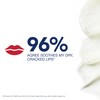 Aquaphor Lip Repair Lip Ointment for Extremely Dry, Chapped and