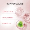 Acne Buster Loción Secante Con Ácido Salicílico 2pcs Todo Tipo