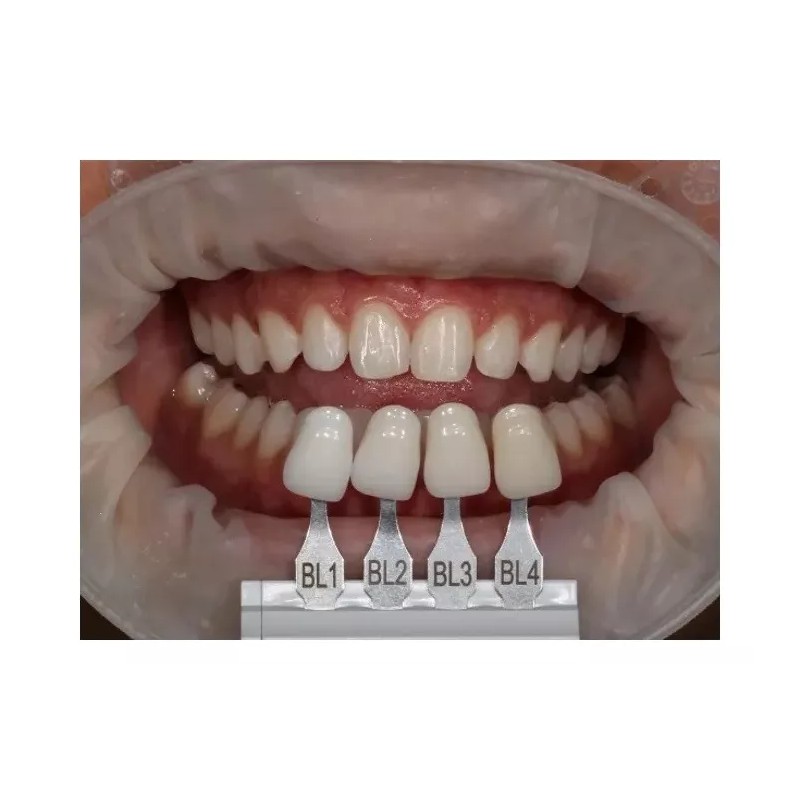 Ultradent Resina Denta Zirconia Forma Ultradent Promocion Bl2 Blanco