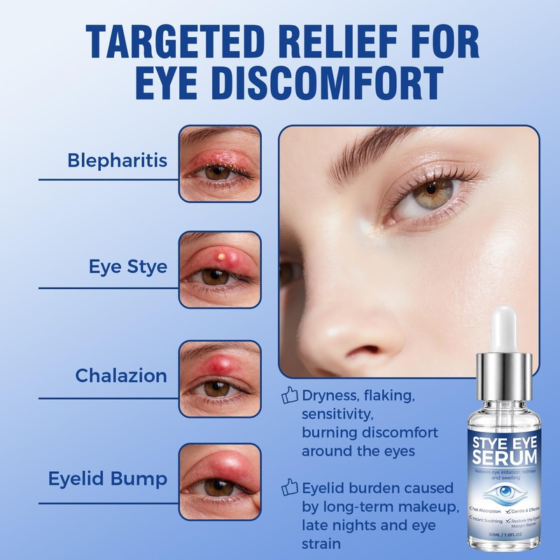 Blepharitis Treatment Serum 30ml, Natural Stye Eye Treatment with Hyaluronic