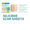 Self Adhesive Silicone Scar Sheets, 4 Counts/set Smoothing Skin Care