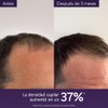 Caudalie Serum Densidad Capilar - 50 mL