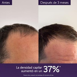 Caudalie Serum Densidad Capilar - 50 mL