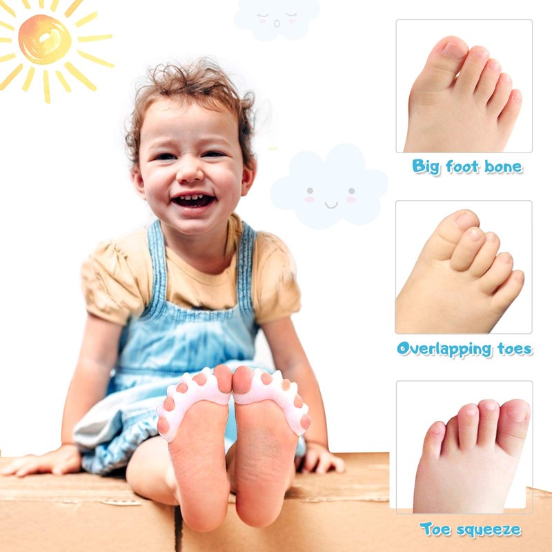 ERSANLI Latest Version Of Children’S Gel Toe Separator And Bunion