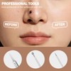 Blackhead Remover Pimple Popper Tool Kit 6 Pcs Blackhead Remover