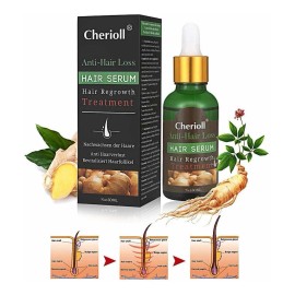 El Crecimiento Del Cabello Suero, Pérdida De Cabello Y AdeLG