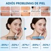 5pc Kit Coreano Weud Para Una Piel Joven, Radiante Y