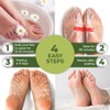 Foot Peel Mask - Peach Feet Peeling Mask 2 Pack