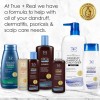 True+real Shampoo Terapéutico T Plus / T Gel 473 Ml