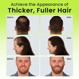 ECLIPSE Hair Fibers Auburn for Thinning Hair for Women & Men to Conceal Hair Loss in 15 Seconds - 100% Undetectable Hair Building Fibers, 15g
