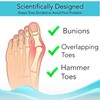 Toe Separators (3 Pairs Blue) - Help Relieve Foot Pain