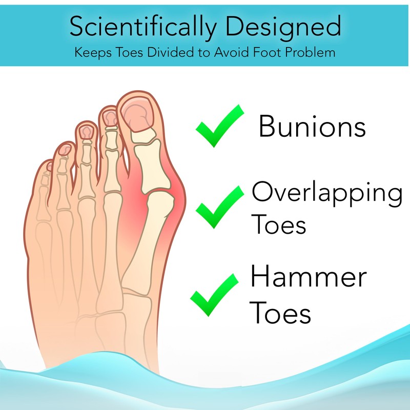 Toe Separators (3 Pairs Blue) - Help Relieve Foot Pain