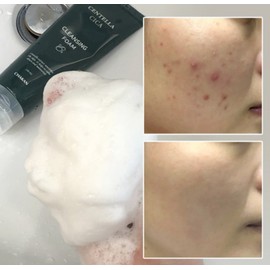 Acne trouble puberty soothing bubble hypoallergenic foam cleansing 120ml / 여드름 트러블 사춘기 진정 버블 저자극 폼클렌징 120ml
