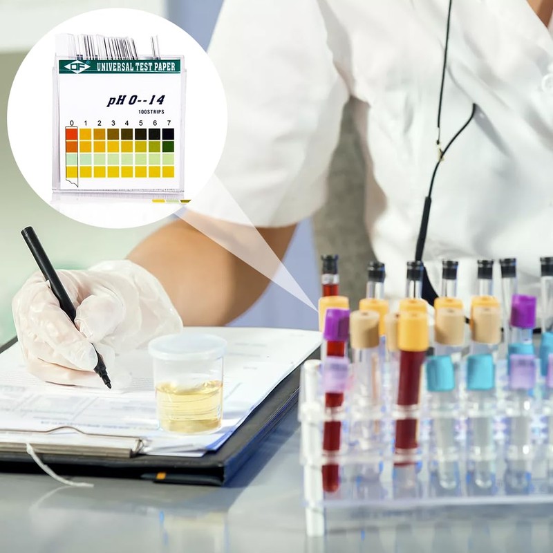 XUKZIMA 100 pH Test Strips for Urine and Saliva –