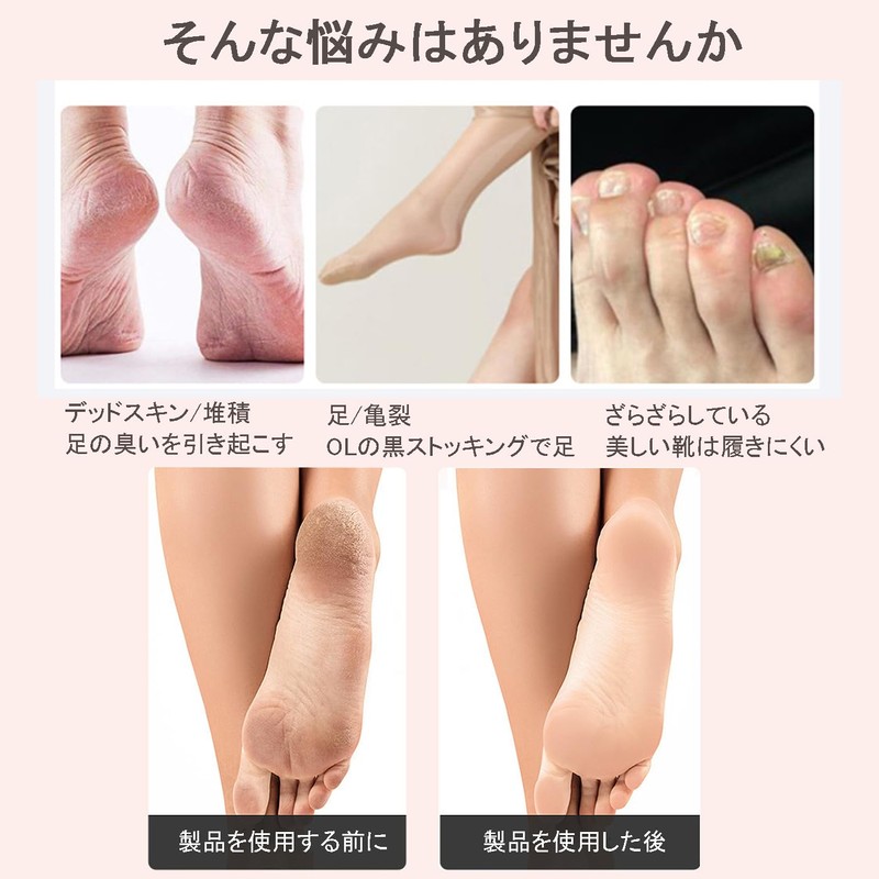 LUYING かかと角質除去器かかと角質除去器かかとヤスリ自宅で簡単、安全、効率的に足のケアを行うことができます。乾燥した繭の両面型は、乾燥した足と濡れた足に適しています（ピンク）