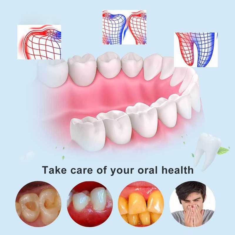 Plaque Remover for Teeth Cleaning with LED 4 Adjustable Modes