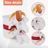 TOBEOME 1:1.5 Human Demonstration Model for Herniated Disc of the
