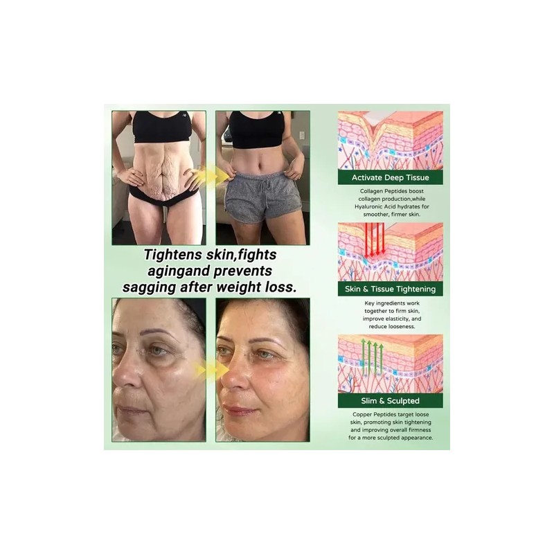 2pcs Parche Glorenda Para Moringa, Parche Nanomicrodarts